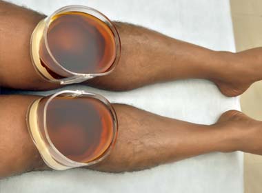 Janu Basti knee therapy Andheri Mumbai